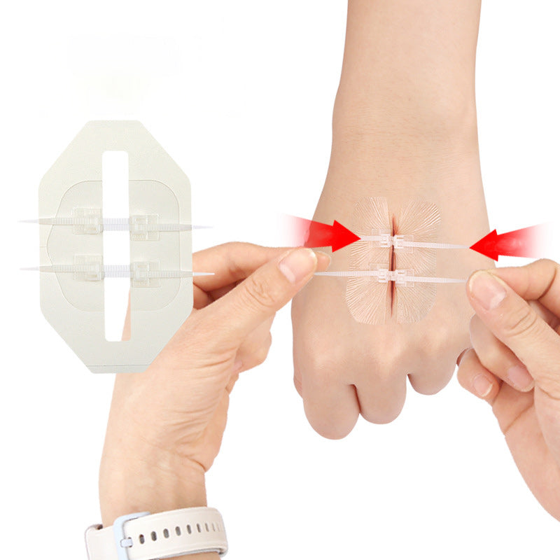 Suture Wound Closure Strips – Zip Stitch & Butterfly Bandage Kit