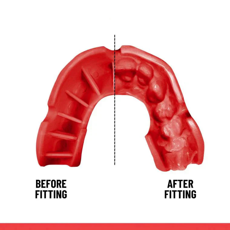 Sports Mouth Guard – Adult & Youth Fit